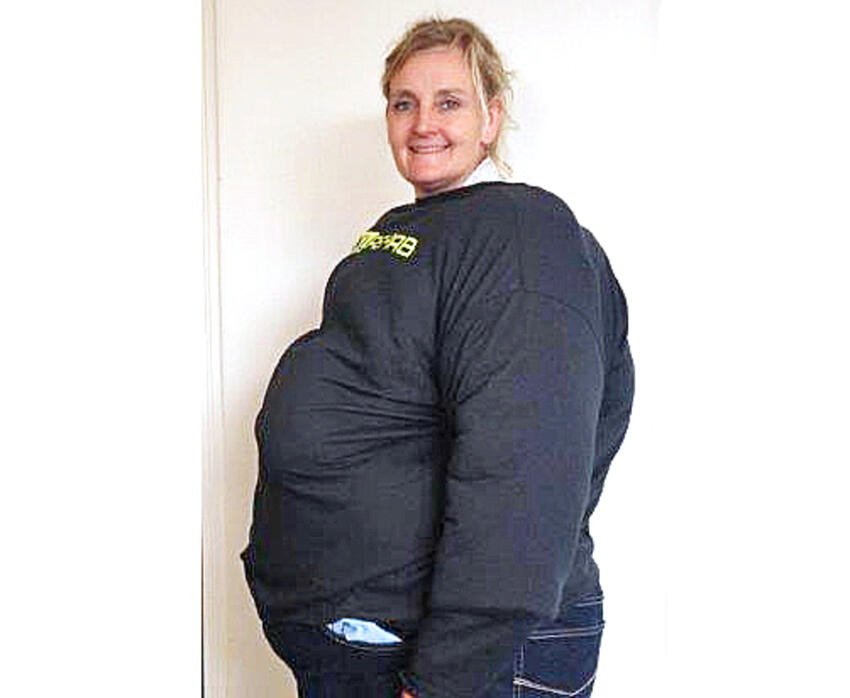 Elever mærker svær overvægt på egen krop