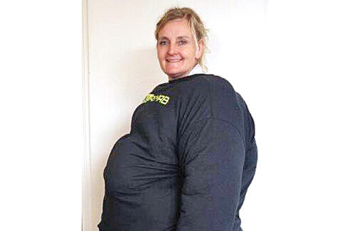 Elever mærker svær overvægt på egen krop