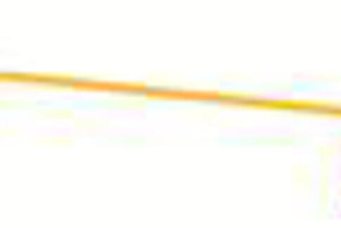 Godt med debat om udligningsordningerne